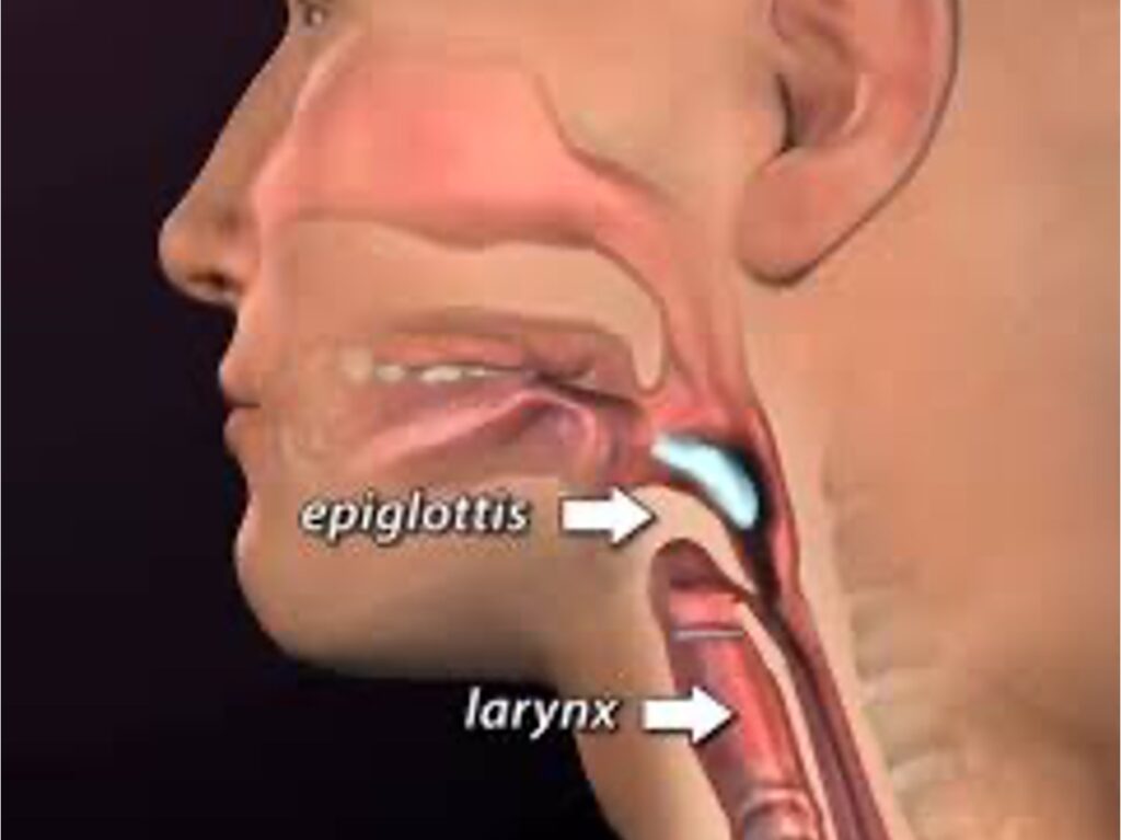 epiglotis