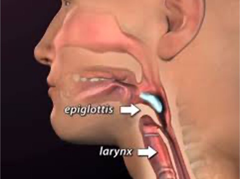 epiglotis