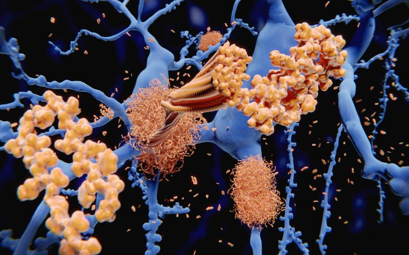 Ilustrasi Bab 17: PROTEIN AGGREGATION: APABILA PROTEIN BERGUMPAL